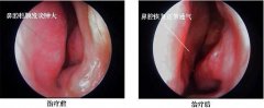 南京哪家医院看鼻子专业