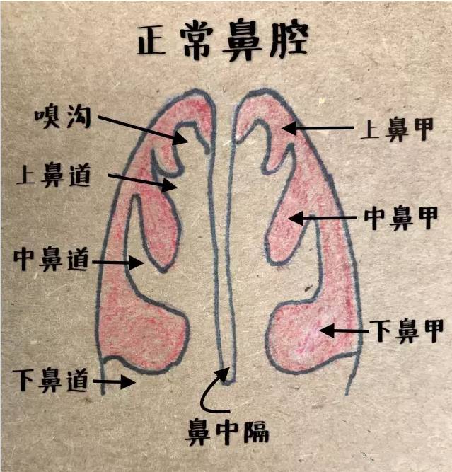 感冒花了那么多冤枉钱还不好,可能患上鼻炎